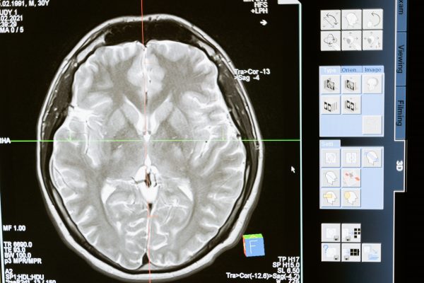 Trasforma le tue parole in soldi 56 – Il bug del cervello che obbliga il cliente a leggere! 9 cervello